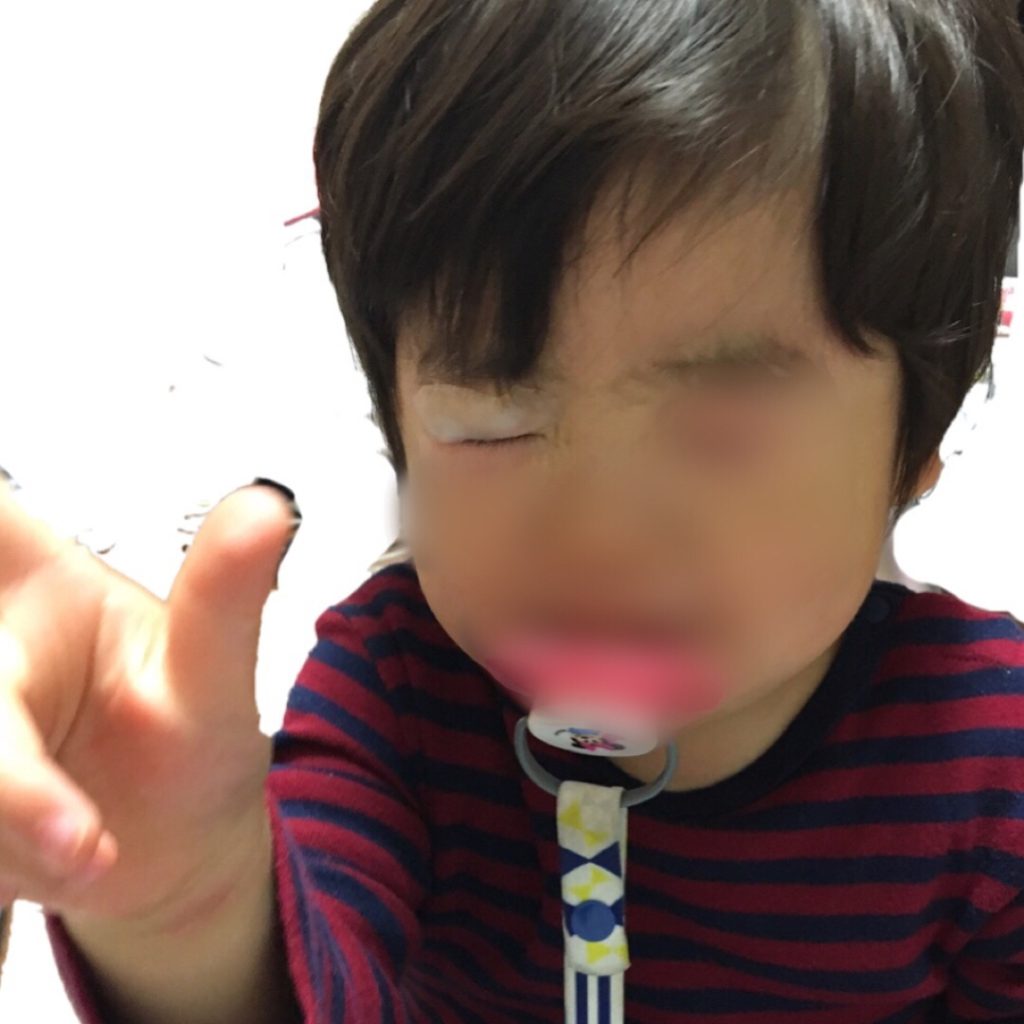 体験談 息子がテーブルの角で瞼を強打 パックリ切れ病院へ傷の処置や経過などレビューしてみる Nachii S Blog